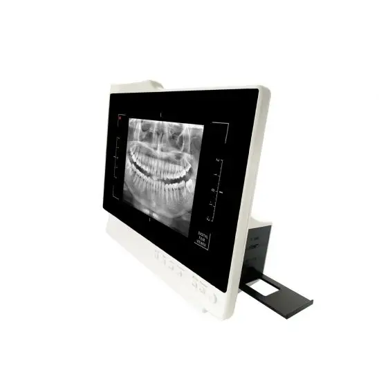 Câmera intraoral imagem 3